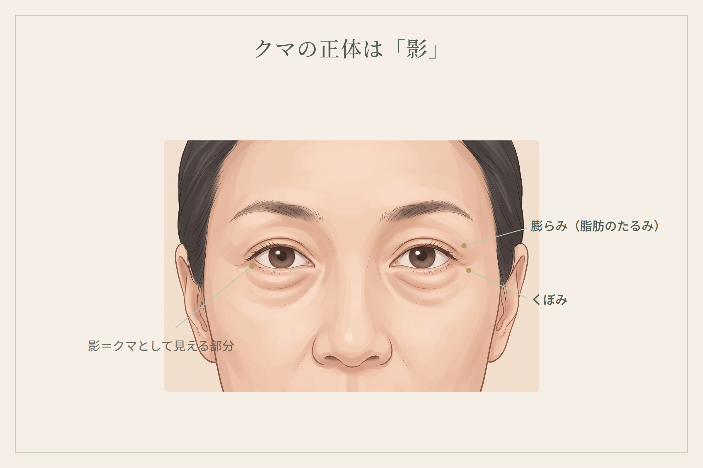 目元の正面図解。膨らみ・くぼみ・影の位置を示す図